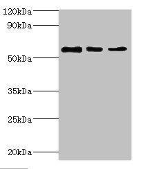 ATP6V1B2 antibody