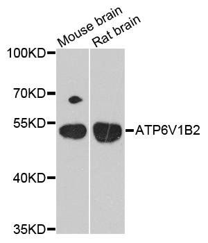 ATP6V1B2 antibody