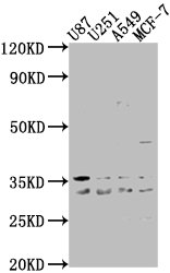 ATP6V1D antibody