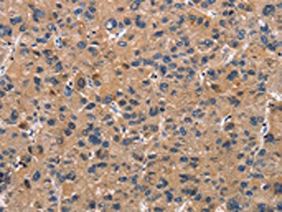 ATP7A Antibody