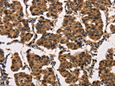 ATP7A Antibody