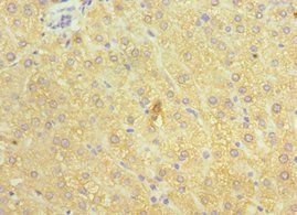ATP7B Antibody