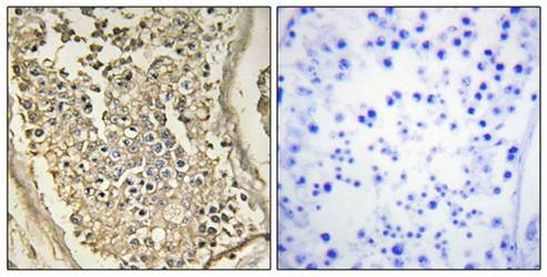 ATP7B Antibody