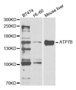 ATP7B antibody