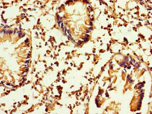ATP8A1 Antibody