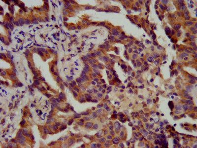 ATPAF1 Antibody