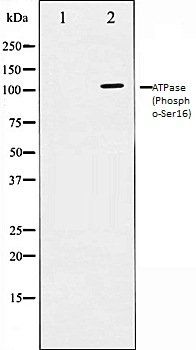 ATPase (Phospho-Ser16) antibody