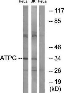 ATPG antibody