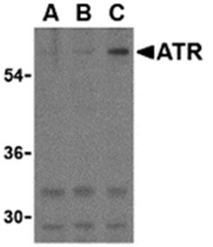 ATR Antibody