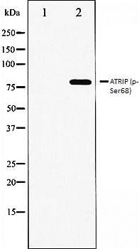 ATRIP (phospho-Ser68) antibody