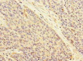 ATRN Antibody