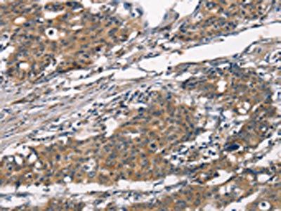 ATRN Antibody