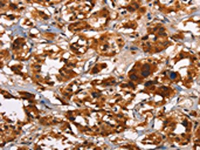 ATRN Antibody