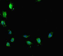 ATRX Antibody