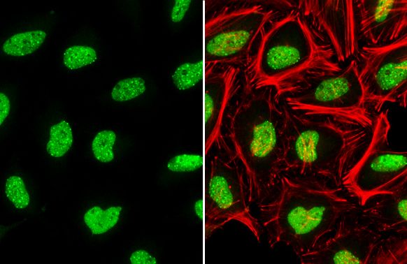 ATRX antibody [C3], C-term