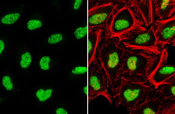 ATRX antibody