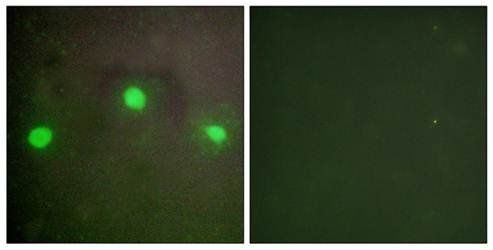 ATRX Antibody
