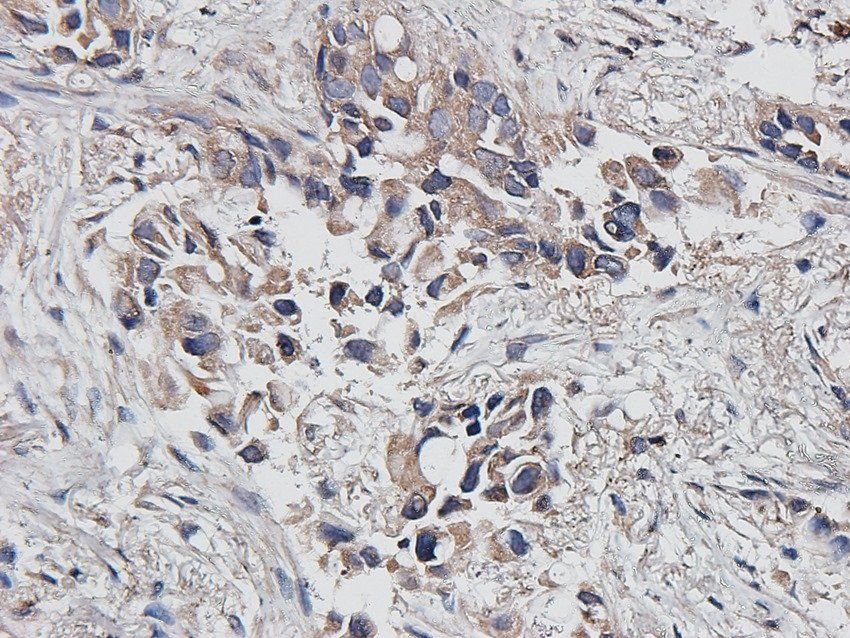ATRX Rabbit Polyclonal Antibody