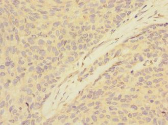ATXN10 Antibody