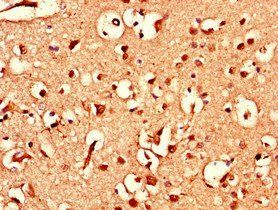 ATXN1L Antibody