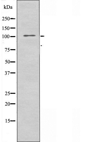 ATXN2L antibody