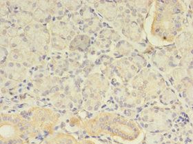 ATXN3 Antibody