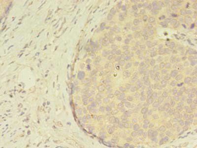 ATXN7L3 Antibody