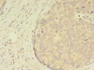 ATXN7L3 antibody