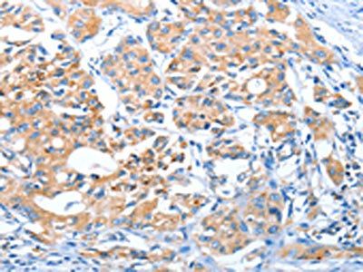 AUP1 Antibody