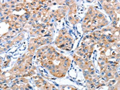 AUP1 Antibody