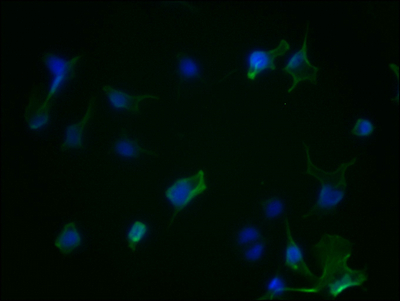 AURKA Recombinant Monoclonal Antibody