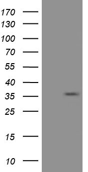 Aurora C (AURKC) antibody