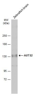 AUTS2 antibody