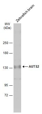 AUTS2 antibody [N3C1], Internal