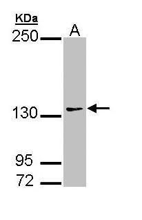 AUTS2 Rabbit Polyclonal Antibody
