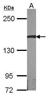 AUTS2 Rabbit Polyclonal Antibody