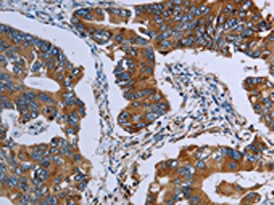 AVEN Antibody