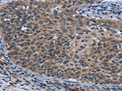 AVEN Antibody