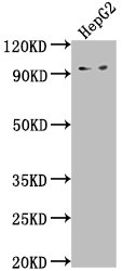 AVIL Antibody