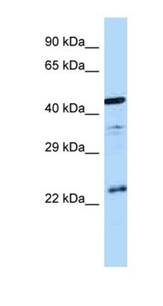 AVPR1B antibody