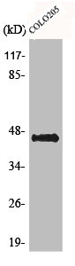 AVPR1B antibody