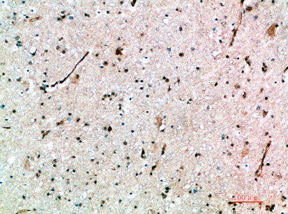 AVPR1B antibody