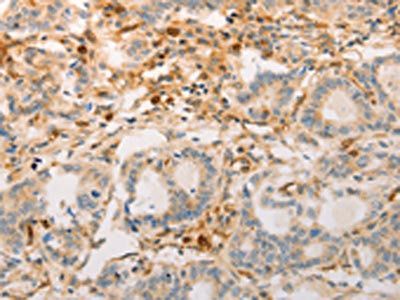 AVPR2 antibody