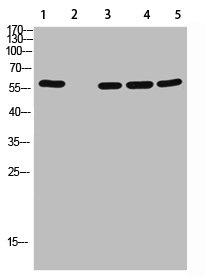 AVPR2 antibody