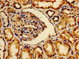 AVPR2 Antibody