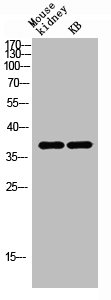 AWAT1 Antibody