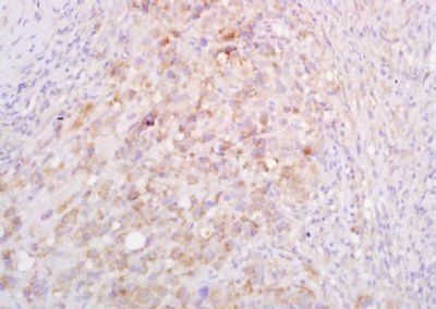 AX2R Rabbit Polyclonal Antibody
