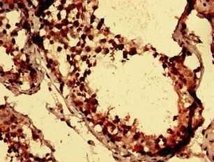 AXIN1 Antibody