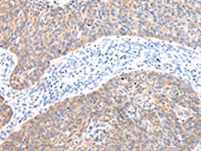 AXIN1 Antibody