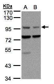 ATP5G1 Rabbit Polyclonal Antibody